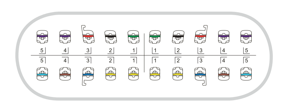 VENUS-A  ROTH Self-ligating Bracket