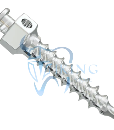 Mini Screw Smart Anchor - GNI (STL File Available)